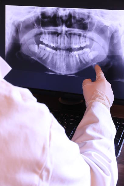 Best Emergency Dental Care for Abscessed Tooth in Crownsville, MD