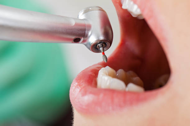 Best Emergency Dentist for Knocked-Out Tooth in Crownsville, MD
